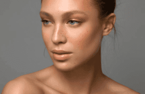 Acne Scar Treatment | Chicago Aesthetic Surgery &Amp; Med Spa