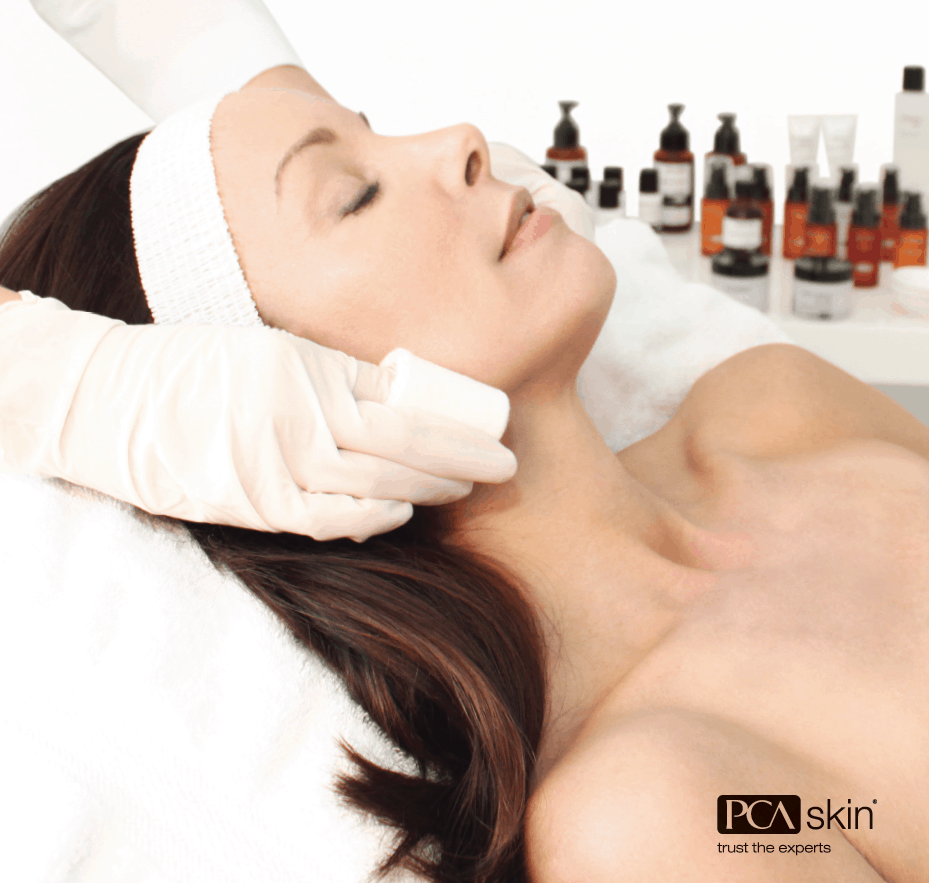 chemical peels for face chicago