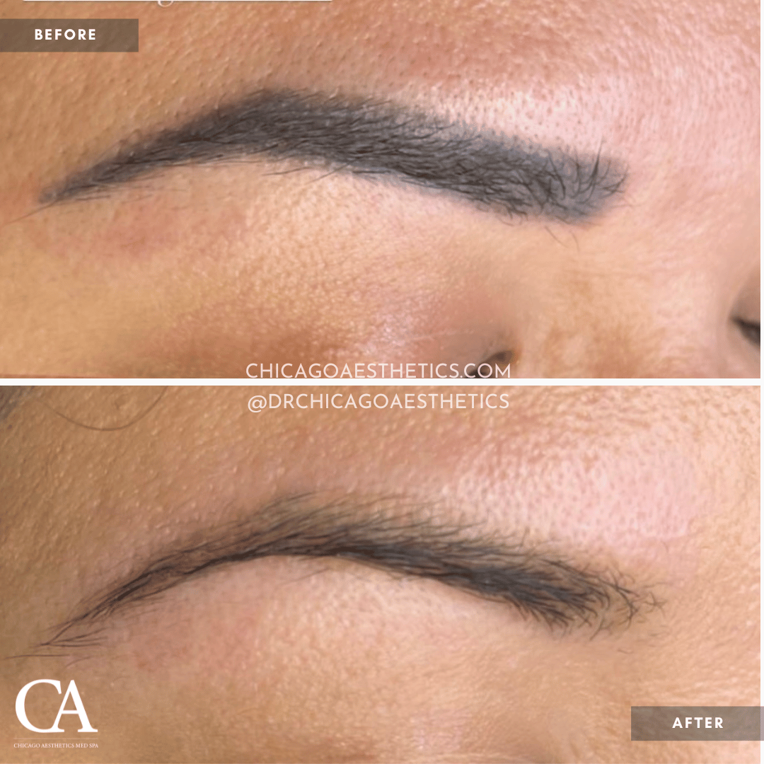 #501 Permanent Makeup Before After Chicago Aesthetics