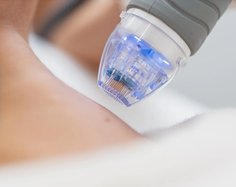 Top 5 Most Popular Non-Invasive Treatments Screenshot 2024 12 15 201119 | Chicago Aesthetic Surgery &Amp; Med Spa