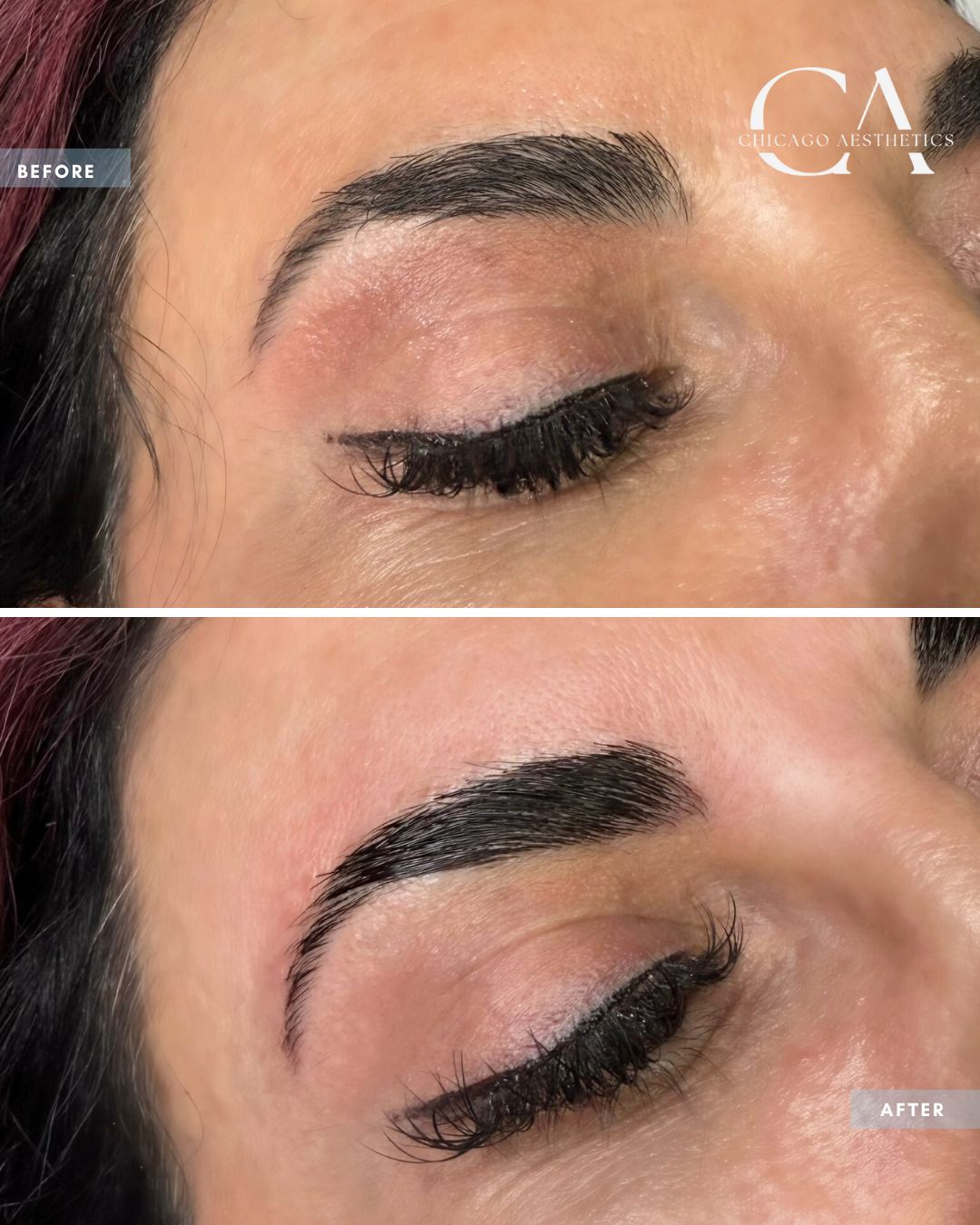 11 | Chicago Aesthetic Surgery &Amp; Med Spa