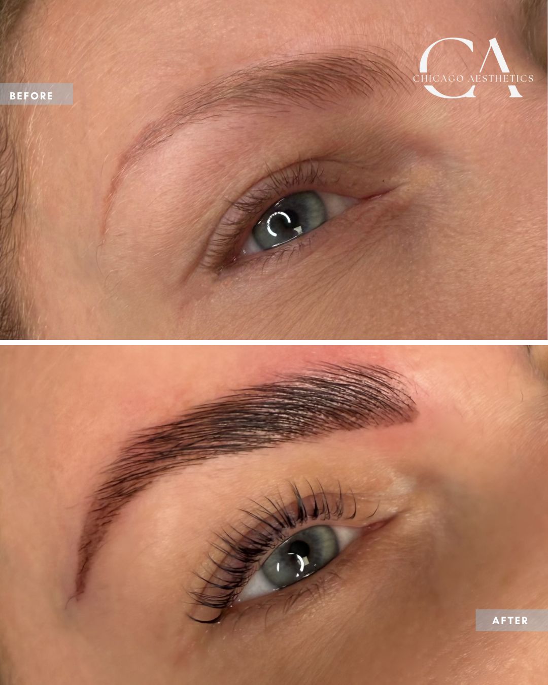 Ca Posts 6 | Chicago Aesthetic Surgery &Amp; Med Spa
