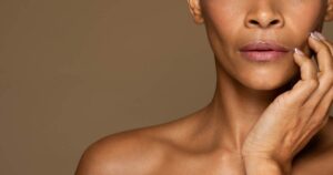 Sculptra Aftercare Instructions Chicago Aesthetics