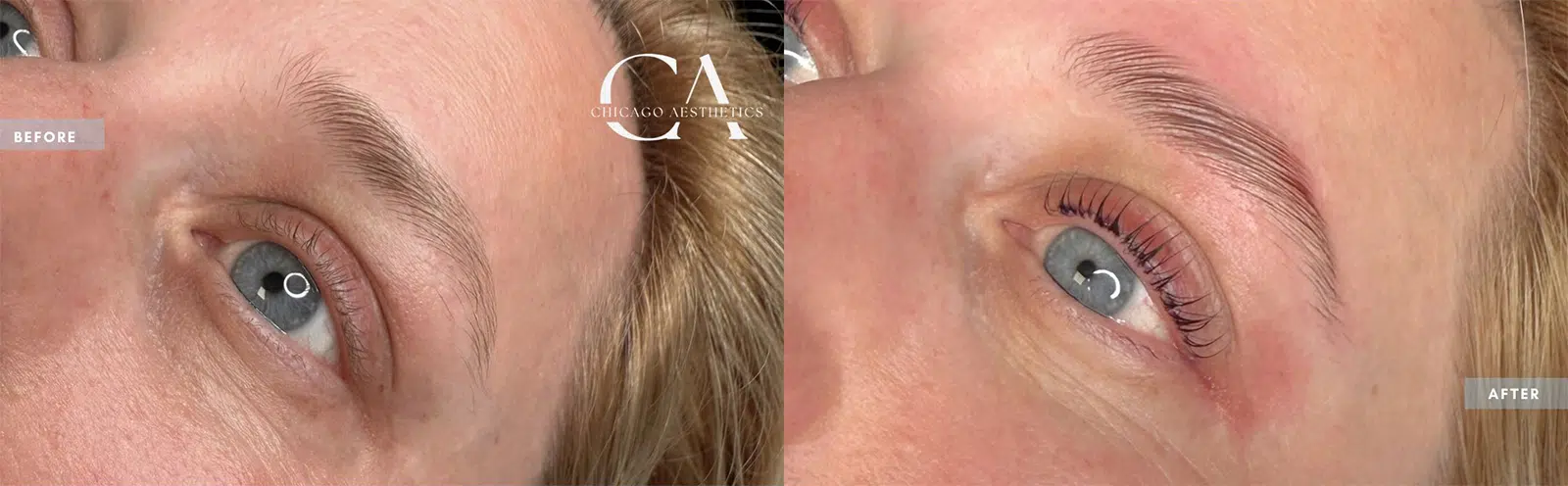 brow lamination & tint before and after photo by chicago aesthetics surgery & med spa in chicago, il