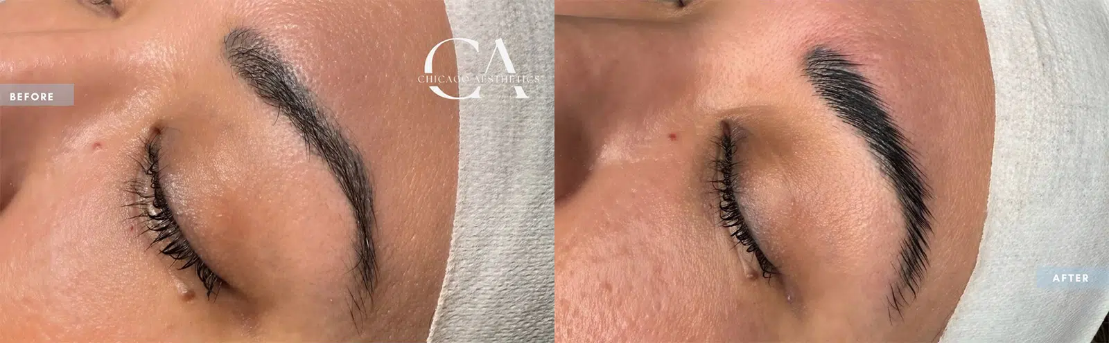 brow lamination & tint before and after photo by chicago aesthetics surgery & med spa in chicago, il