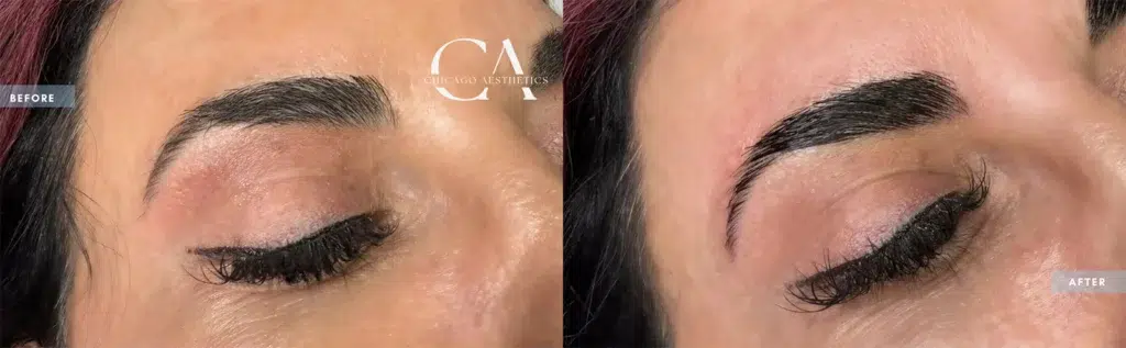 Brow Lamination & Tint before and after photo, case #21815233, Chicago Aesthetics Surgery & Med Spa