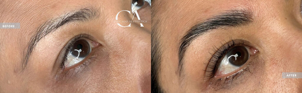 Brow Lamination & Tint before and after photo, case #1030005, Chicago Aesthetics Surgery & Med Spa