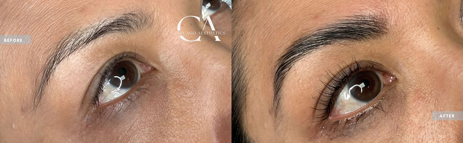 Stephanie Sanchez CA Before & After