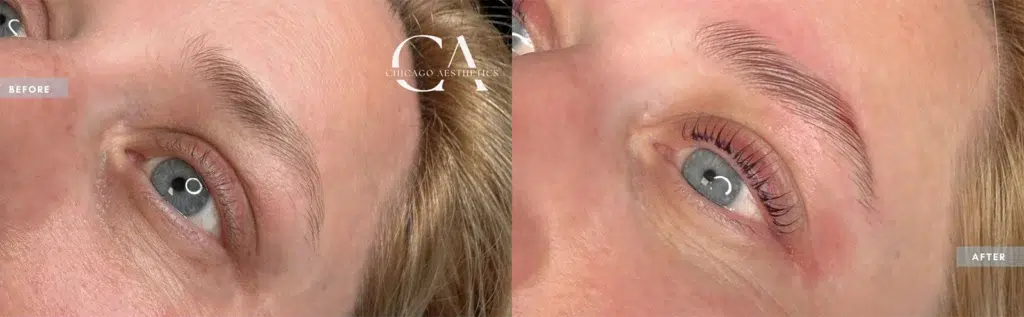 lash lift & tint before and after photo by chicago aesthetics surgery & med spa in chicago, il