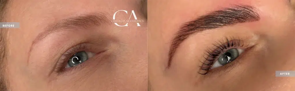 lash lift & tint before and after photo by chicago aesthetics surgery & med spa in chicago, il