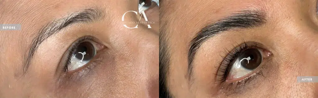 lash lift & tint before and after photo by chicago aesthetics surgery & med spa in chicago, il