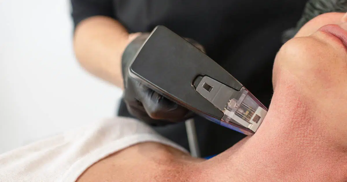 9 Facts About Morpheus8 | Chicago Aesthetics Med Spa