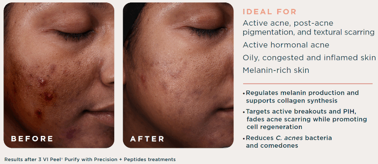 Screenshot-2025-09-30-152053-1536X665