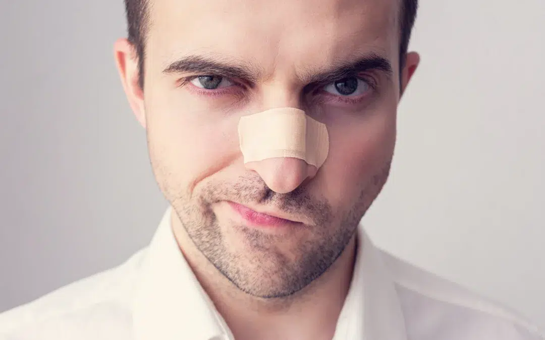 angry man with a broken nose