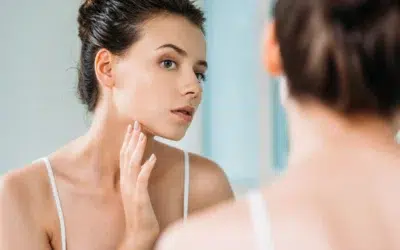 MOXI Laser Treatment for Melasma in Chicago