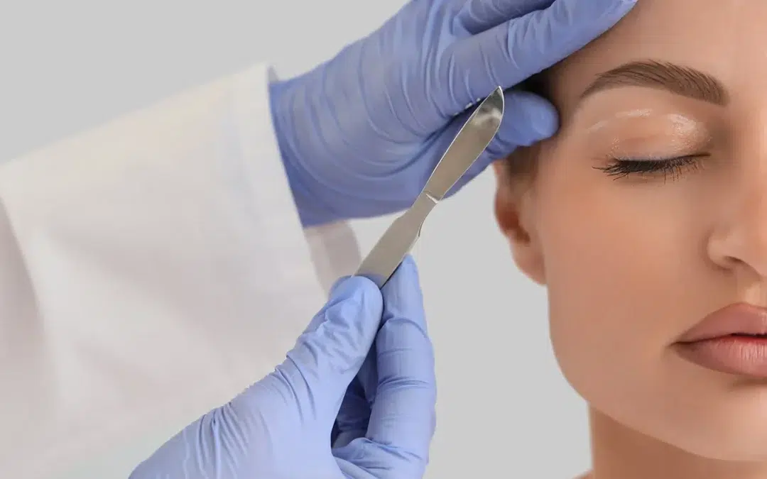 Blepharoplasty for Vision Improvement: Functional vs. Cosmetic Benefits