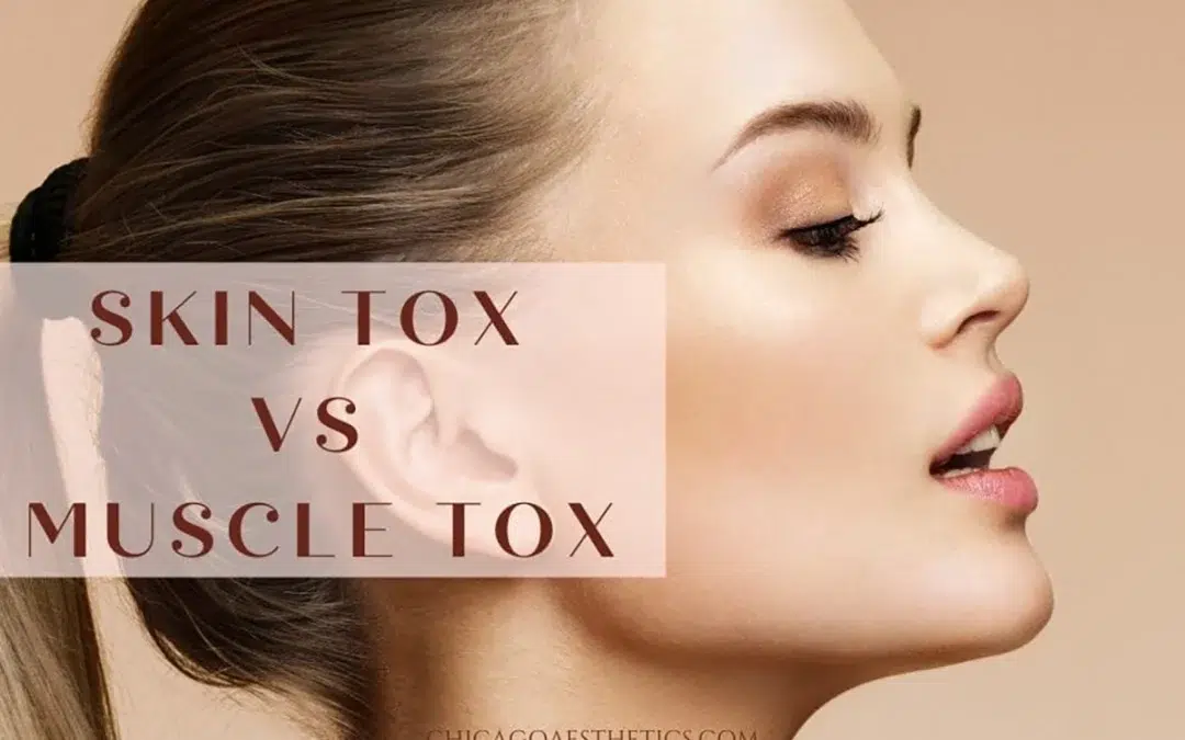 botox facial slimming
