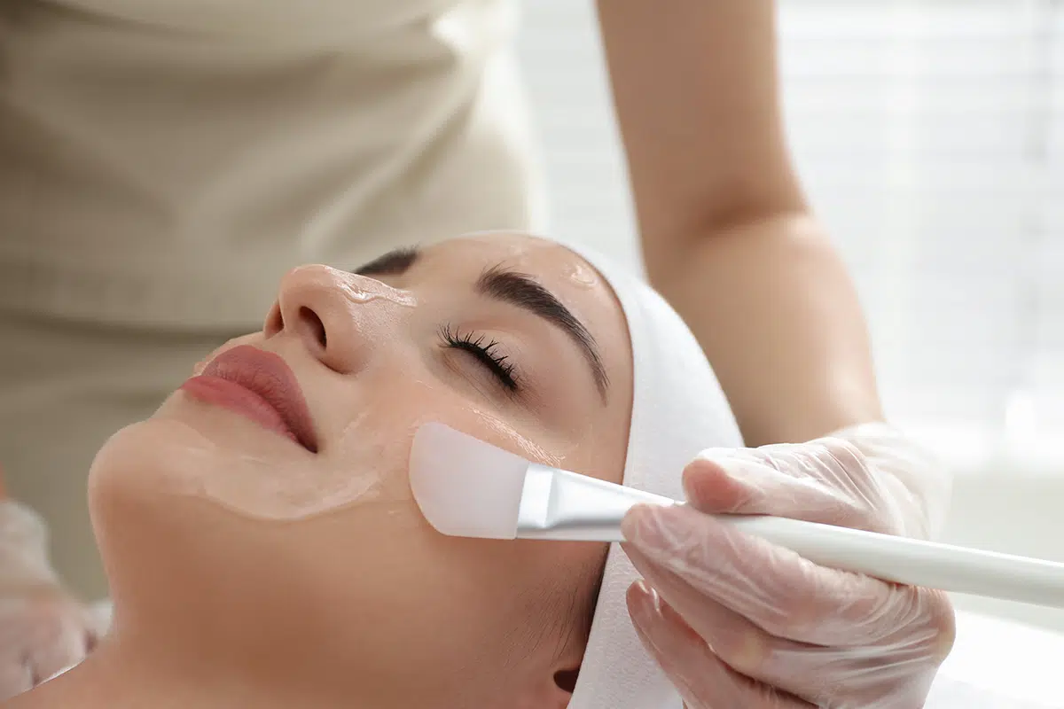 Chemical-Peel-In-Summer-Best-Skincare-Treatments-For-Summer