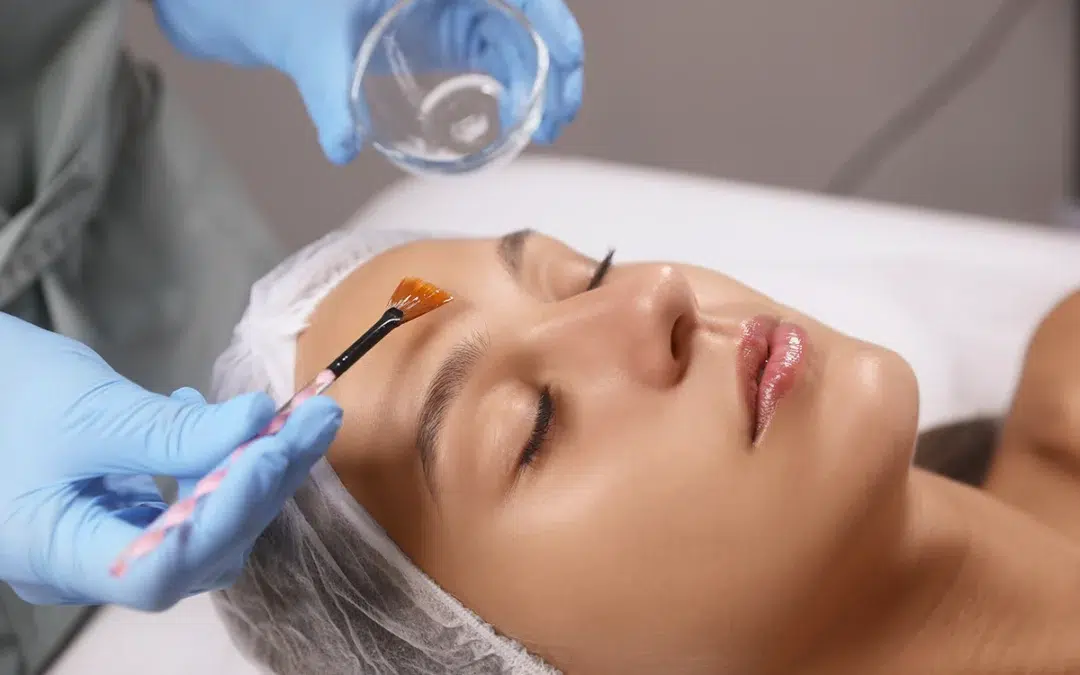 cosmetologist applying chemical peel product on clients face