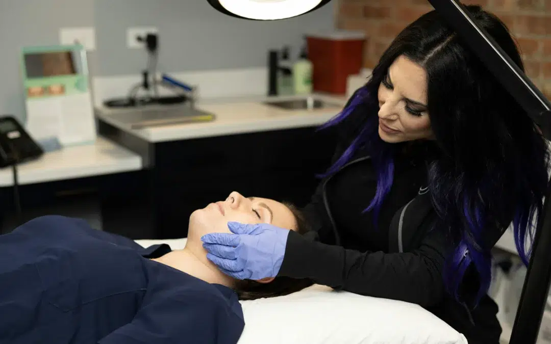 ipl photofacial