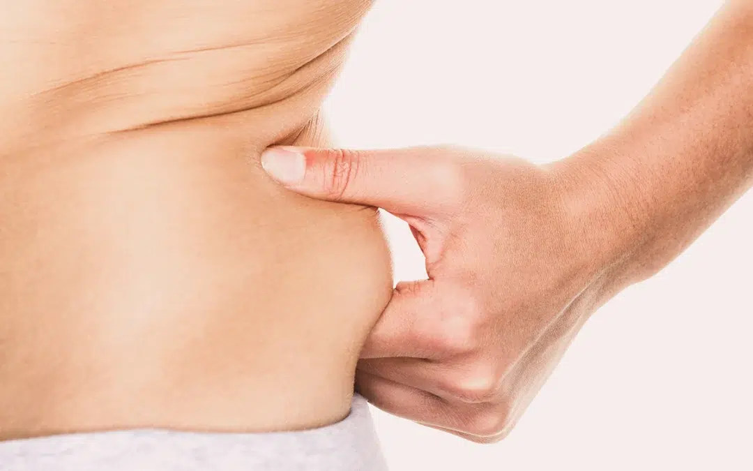 love handle woman pinching fat on hips around waist