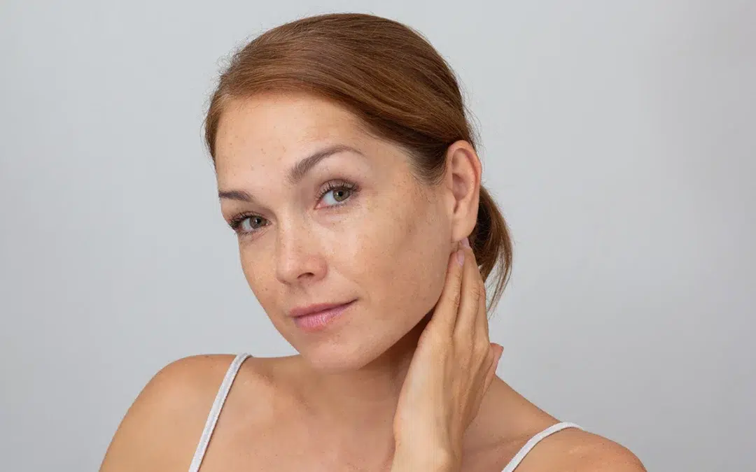 middle aged woman face with freckles holding hand on neck