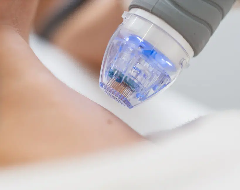 Screenshot 2024 12 15 201119 | Chicago Aesthetics Med Spa