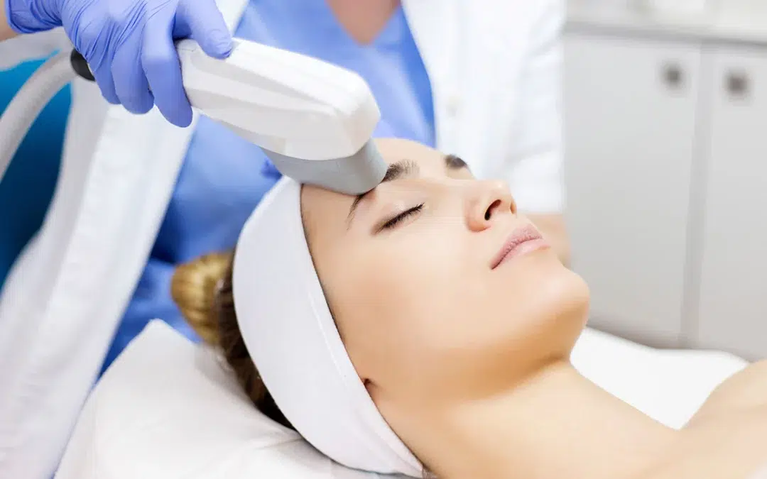 sofwave non surgical skin lifting treatment
