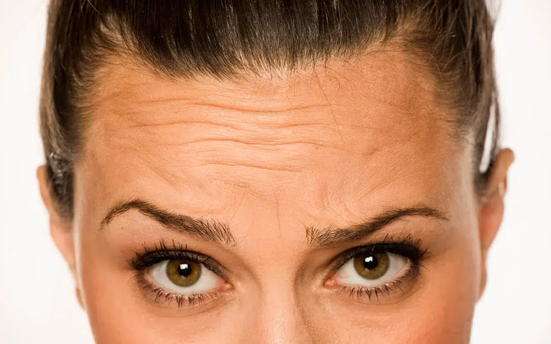 woman showing her forehead wrinkles