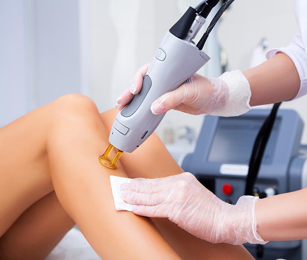 Close-up of a female cosmetologist in a medical coat making a young woman a procedure laser hair removal for leg.