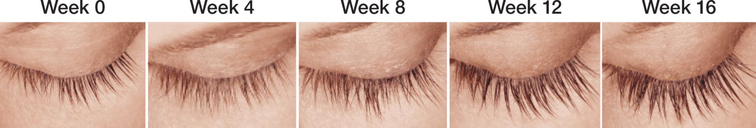 Latisse™ lash serum progress chart