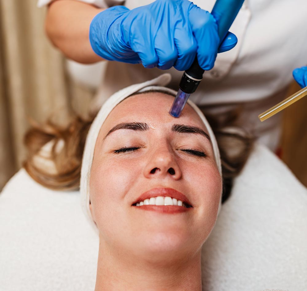 Beautician wearing blue gloves uses a microneedling pen to apply serum to forehead of client with closed eyes lying on a treatment table during a beauty spa procedure.