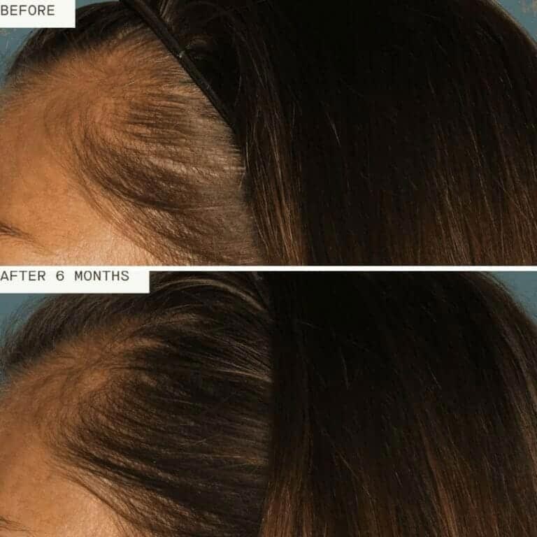 nutrafol before after slider image one