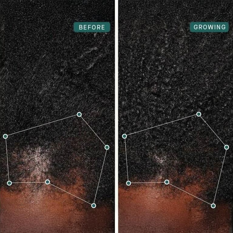 nutrafol before after slider image three