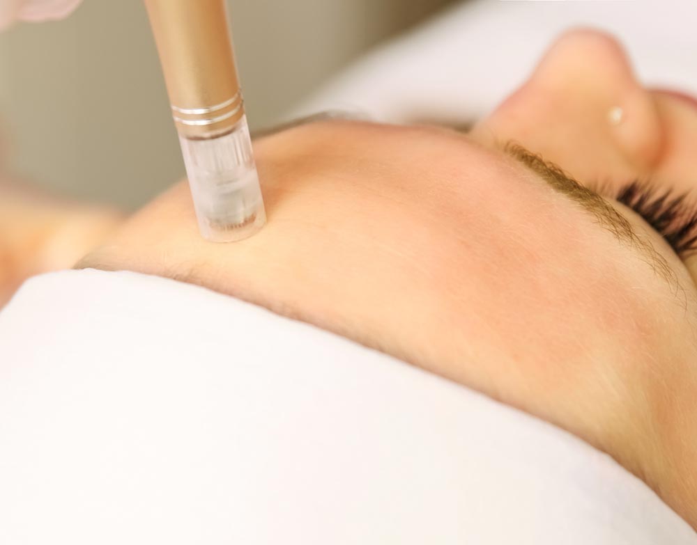 Beautician cosmetologist doing procedure fractional microneedle