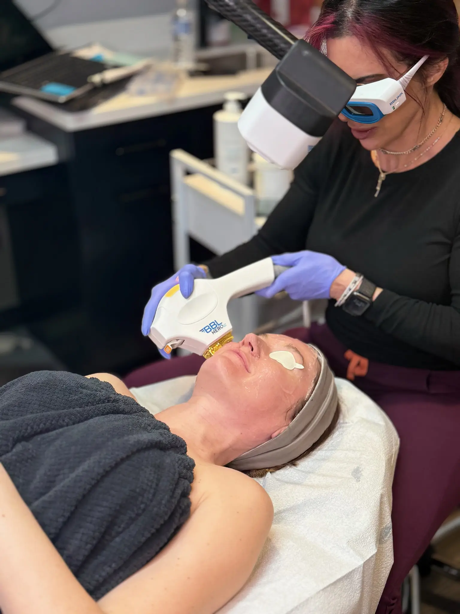 Top Winter Skincare Treatments female patient receiving ipl bbl treatments