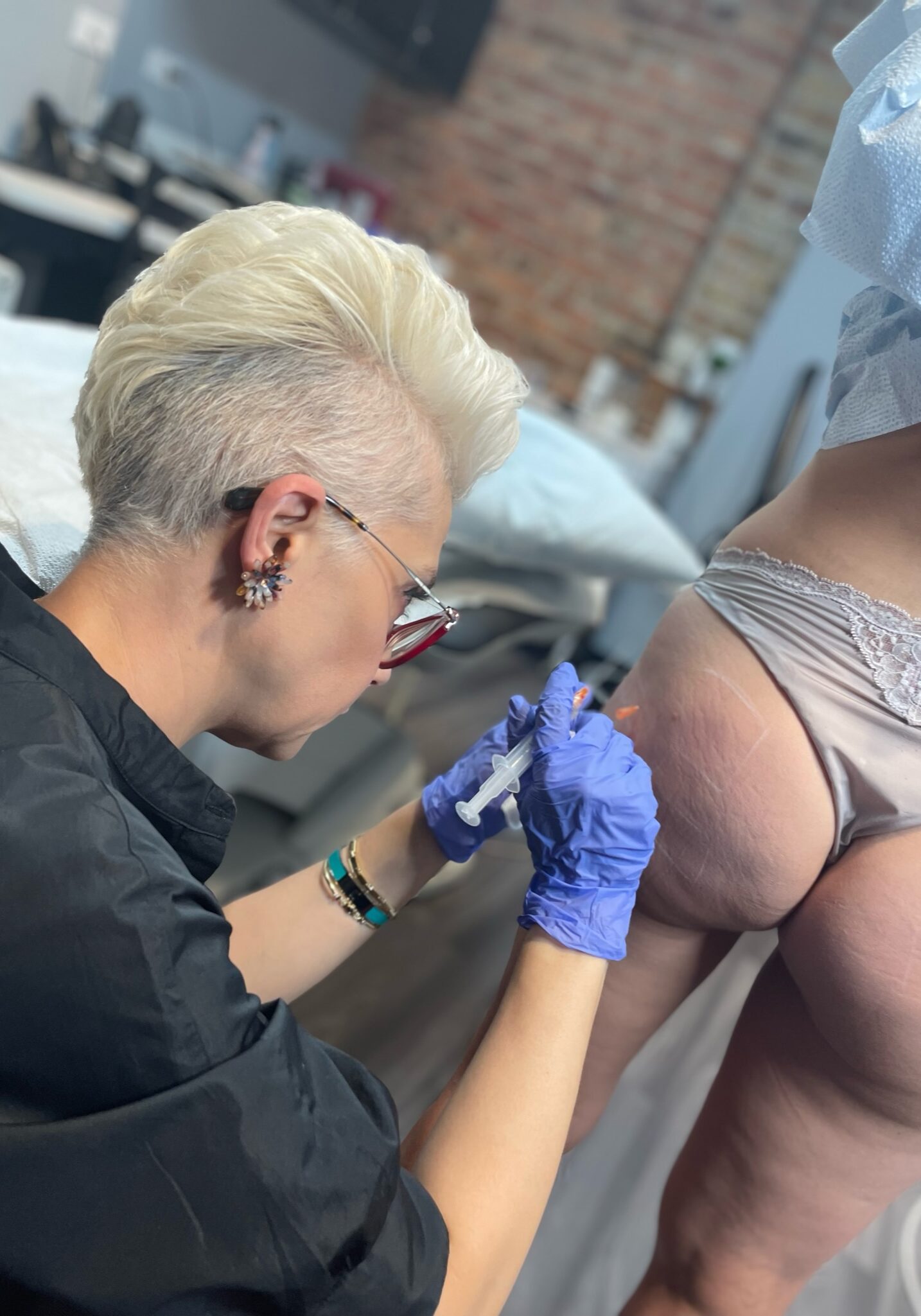 Butt Injections Sculptra Chicago Illinois Dr. Sue Kafali